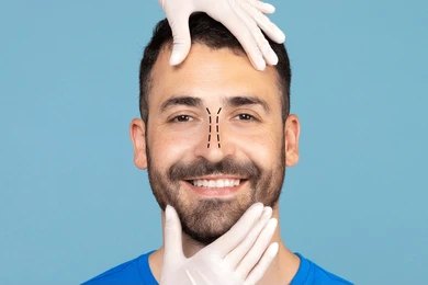 Male Rhinoplasty